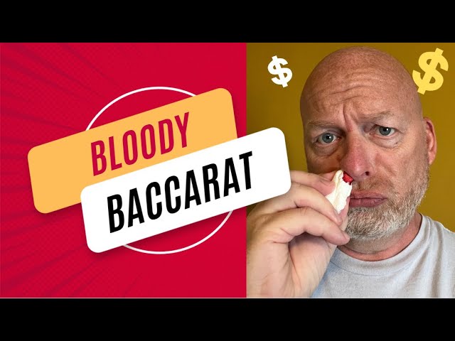 Baccarat Live – Took a loss